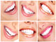 Dental Zone Affordable Dentistry in Sheikhpura, Patna