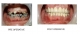 Radha Dental Care  in Bailey Road, Patna
