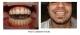 Radha Dental Care  in Bailey Road, Patna