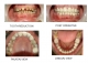 Radha Dental Care  in Bailey Road, Patna