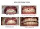 Radha Dental Care  in Bailey Road, Patna